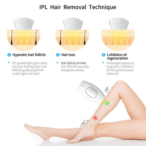 IPL Laser Hair Removal - ulcerskin